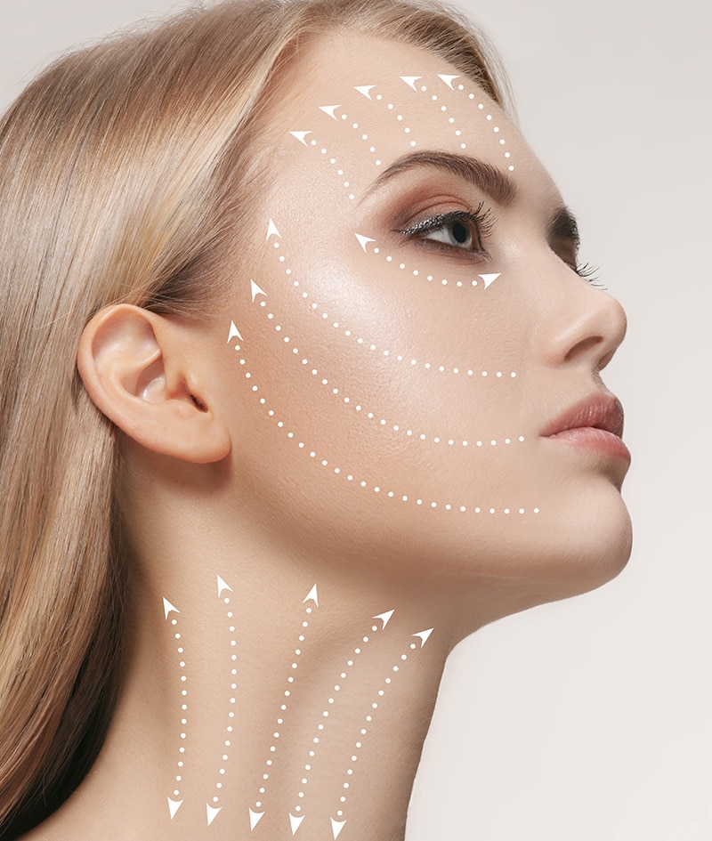 Soin Radiesse des rides et contours du visage