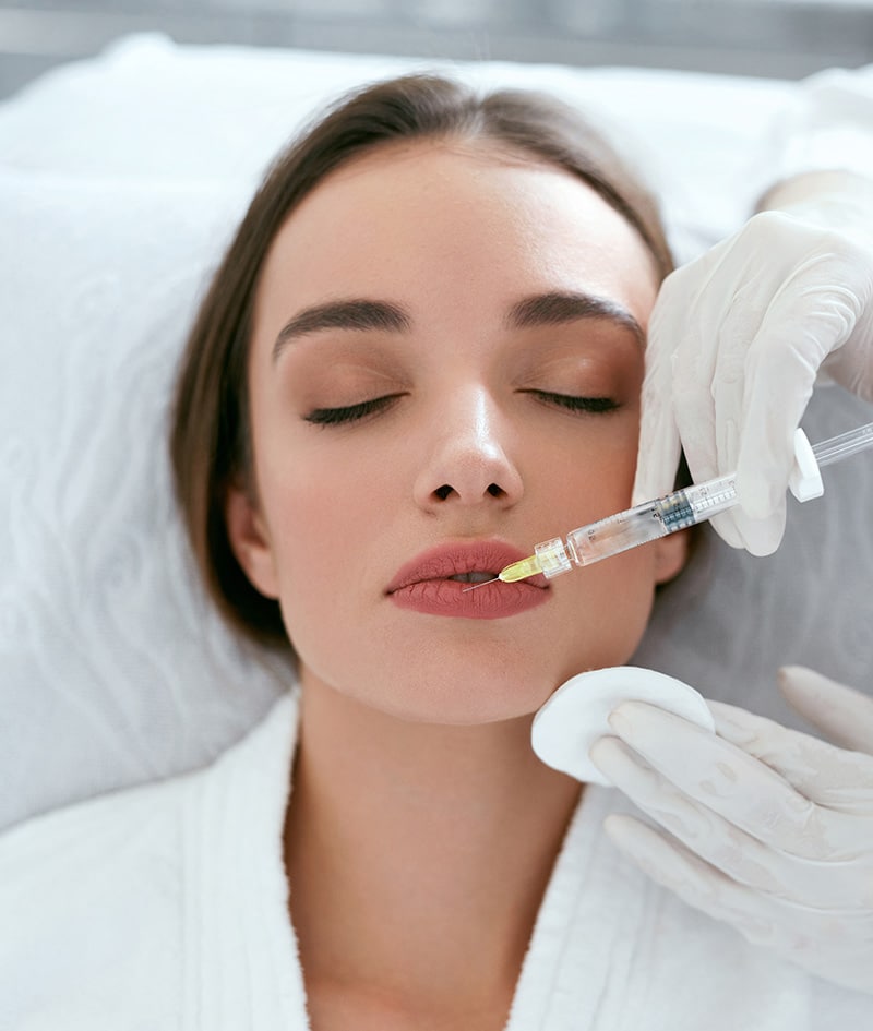 Injection acide hyaluronique dans les lèvres