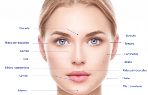 Comblement des rides et zones creusées du visage en Belgique