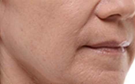 Sillons et contours du visage