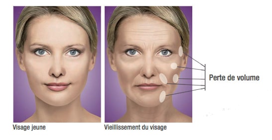 Contours et volumes du visage